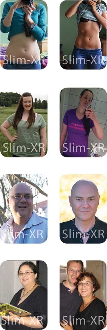 Slim-XR